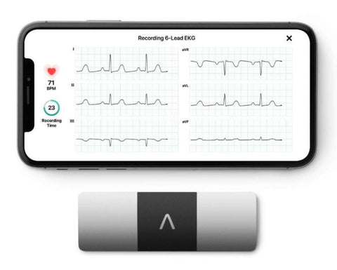 AliveCor KardiaMobile 6L Wireless 6-Lead EKG Detects AFib or Normal Heart Rhythm