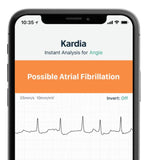 AliveCor KardiaMobile 6L Wireless 6-Lead EKG Detects AFib or Normal Heart Rhythm