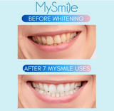 MySmile 3-PC Teeth Whitening Whitener Gel Pen Treatment Refill Pack Only