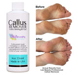 Lee Beauty Professional Callus Remover Removal Gel for Feet Pedicure Manicure 236 ML